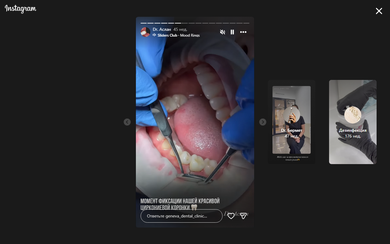 Циркониевые коронки