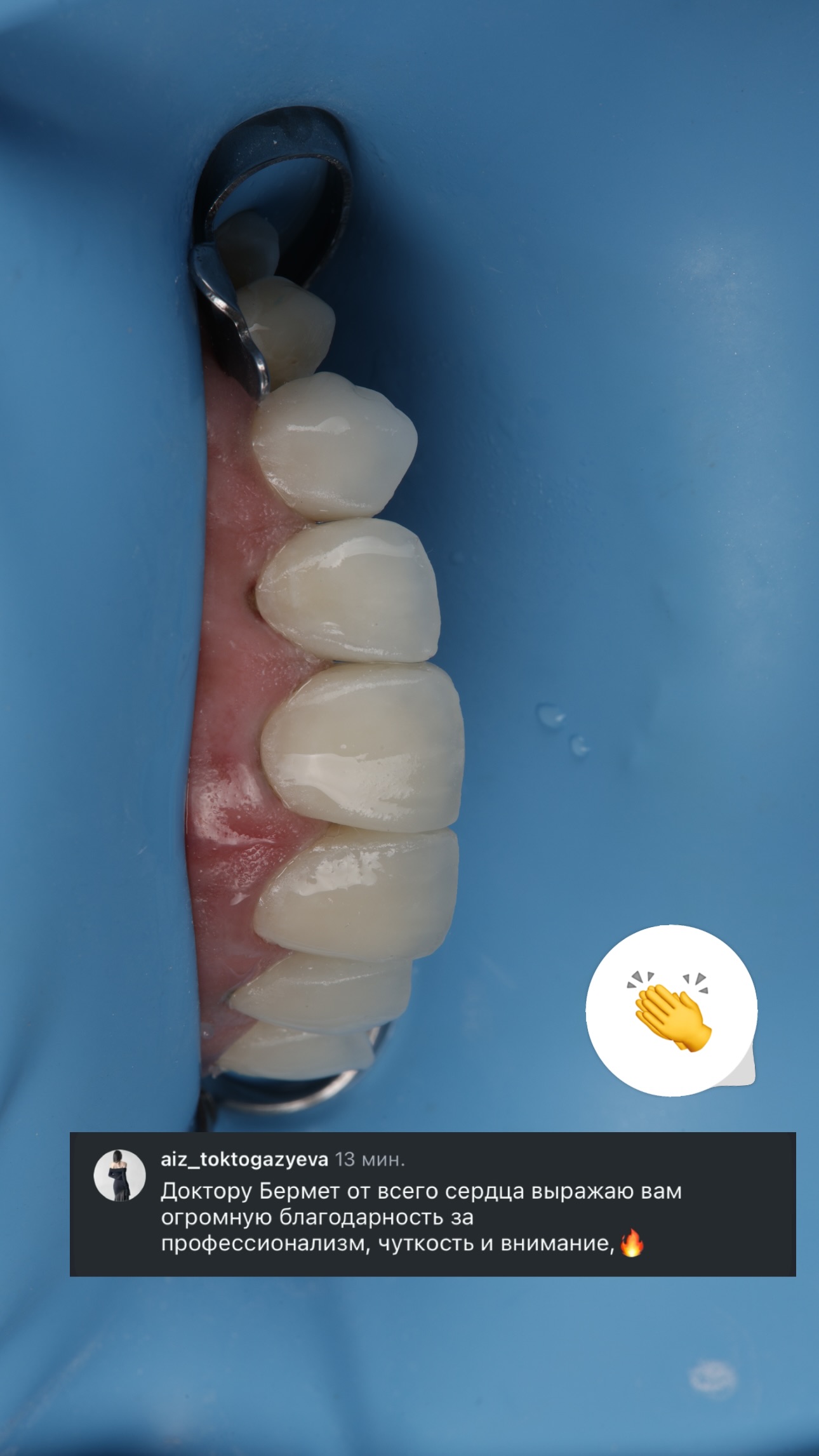 Результат лечения