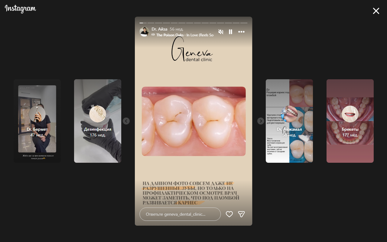 Замена пломб