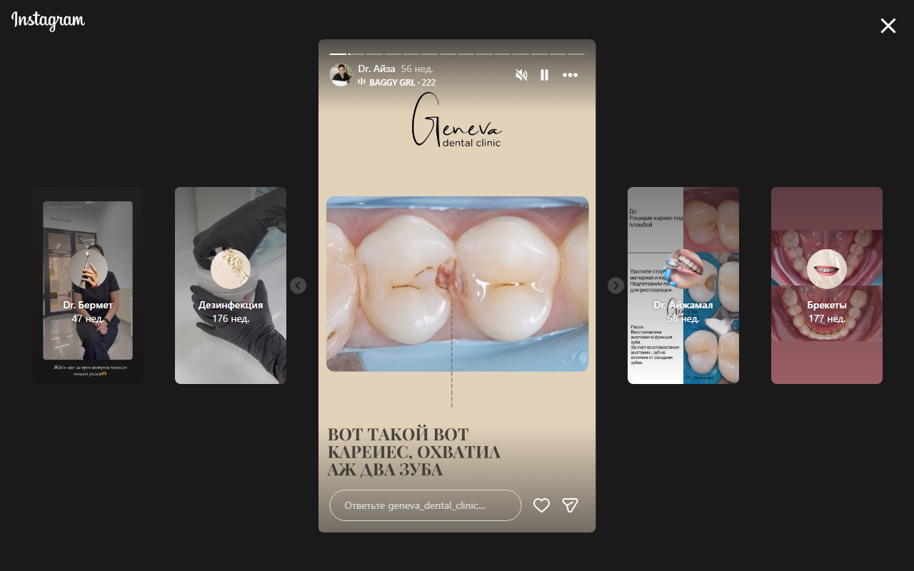 До — кариес