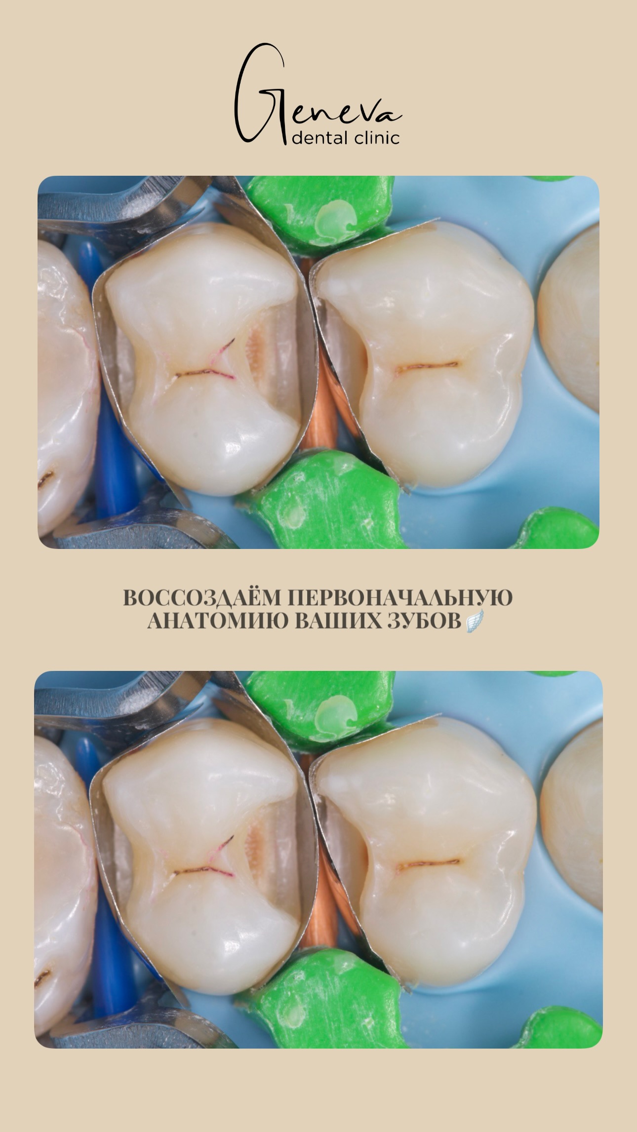 Художественная реставрация