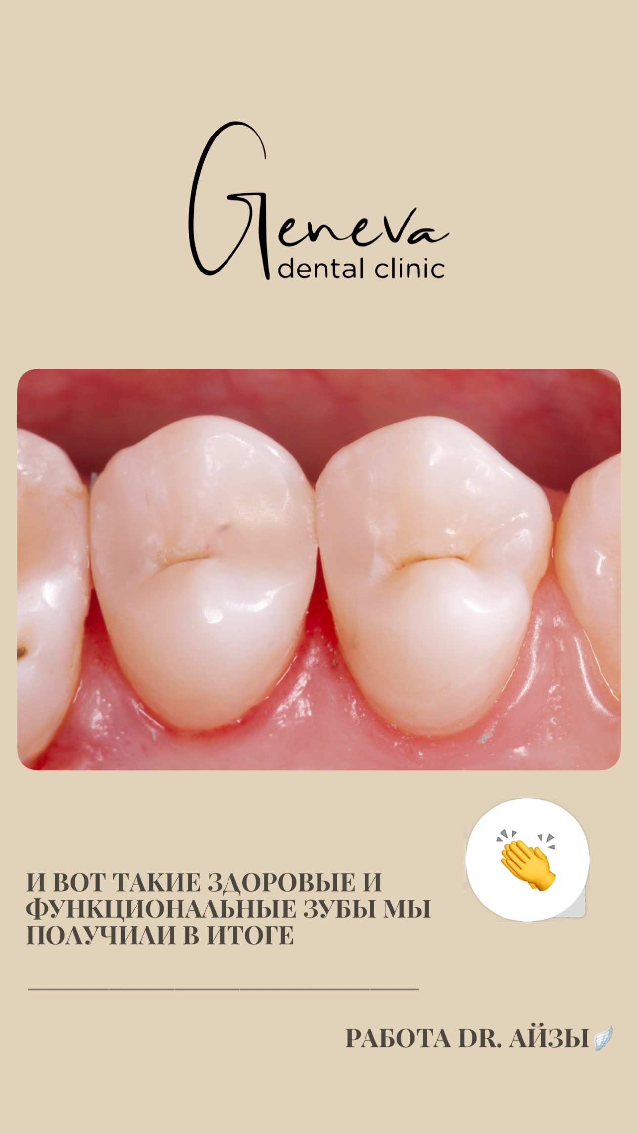 Результат лечения